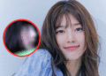 Is Suzy’s Nose Job Just a Rumor? Knetz Fight Back with Receipts