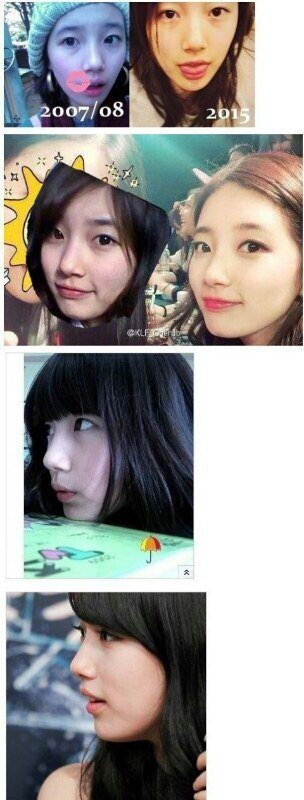 Is Suzy’s Nose Job Just a Rumor? Knetz Fight Back with Receipts