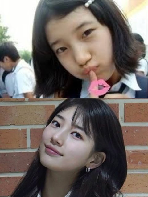 Is Suzy’s Nose Job Just a Rumor? Knetz Fight Back with Receipts